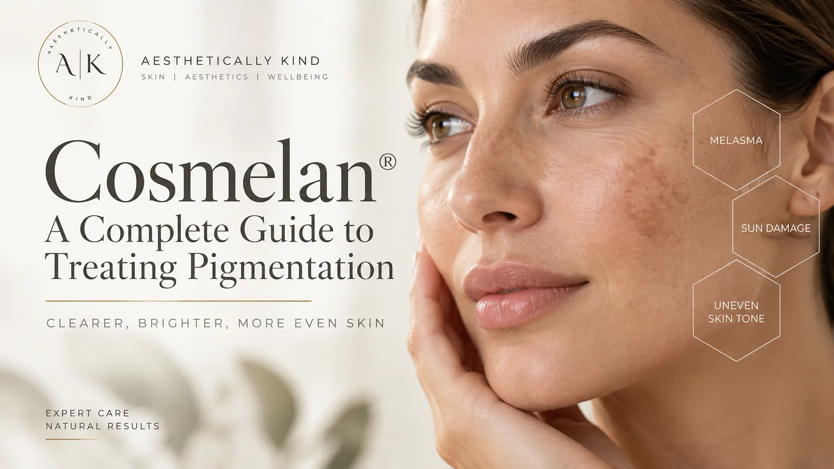 Cosmelan pigmentation treatment